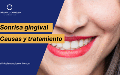 ¿Qué es la Sonrisa Gingival? Causas, riesgos y cómo prevenirla en 2025