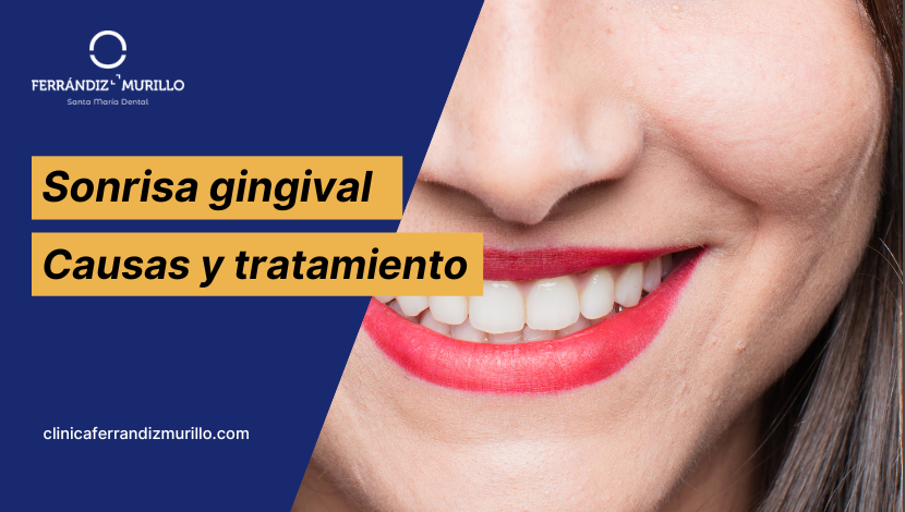 ¿qué es la sonrisa gingival?