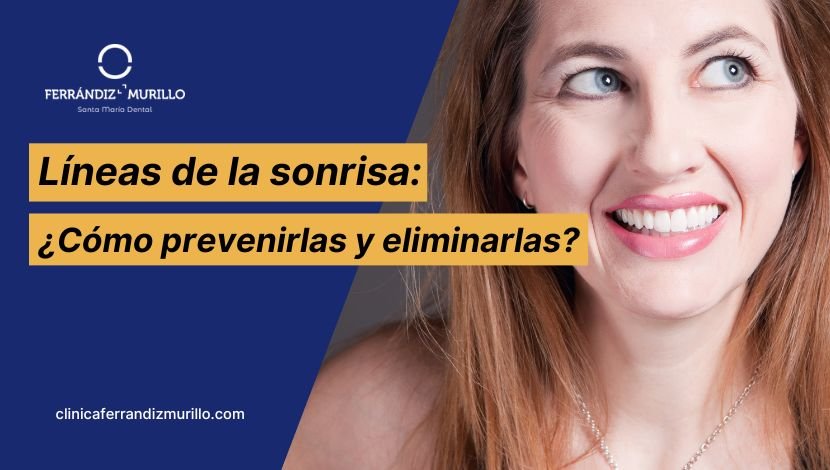 ¿Qué son las Líneas de la Sonrisa? Técnicas y Formas de prevenirlas en 2025