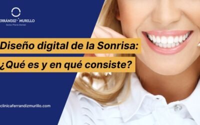 ¿Qué es el Diseño Digital de la Sonrisa (DSD) y en qué consiste?
