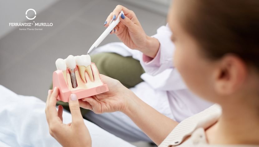 Qué es un Implante dental