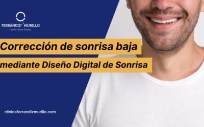 Corrección de sonrisa baja mediante Diseño Digital de Sonrisa (DSD)