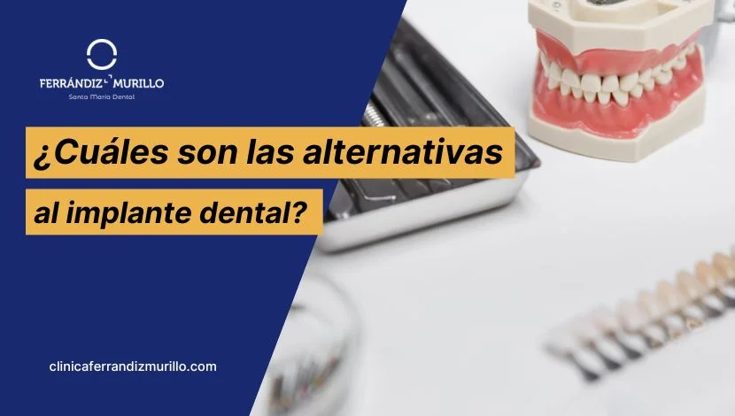 Cuáles son las alternativas al implante dental