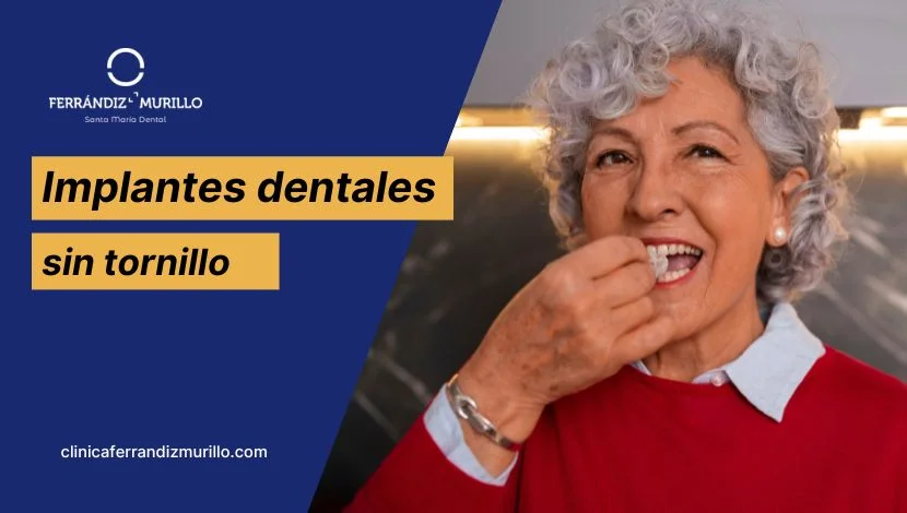 Implantes dentales sin tornillo