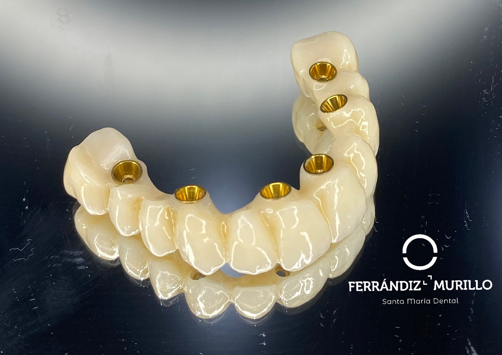 Tornillos para colocación de implantes dentales