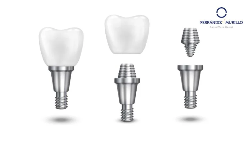 Implante dental barato
