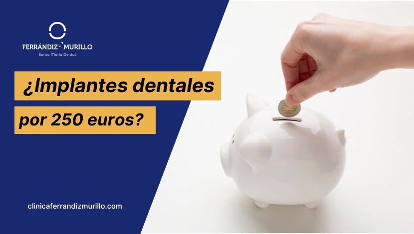 ¿Implantes dentales por 250 euros? Todo lo que debes saber antes de decidir