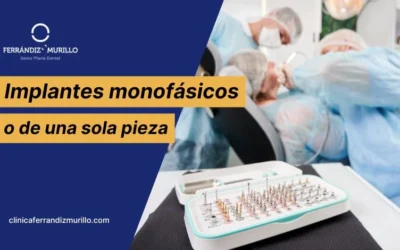 Implantes monofásicos o de una sola pieza: ventajas y desventajas