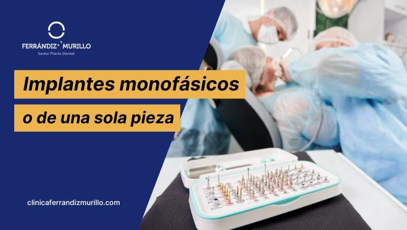 Implantes monofásicos o de una sola pieza: ventajas y desventajas
