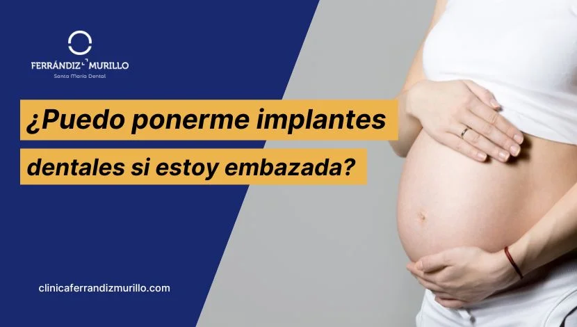 ¿Puedo ponerme implantes dentales si estoy embarazada?