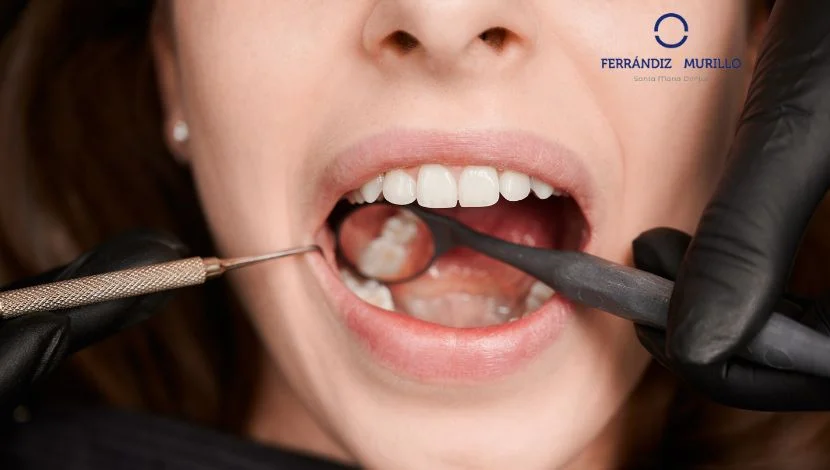 Qué hacer con un implante dental con una infección