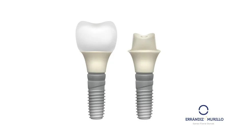 Ventajas y desventajas de los implantes monofásicos