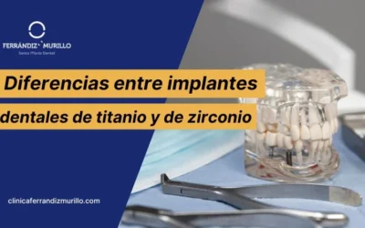 Diferencias entre implantes dentales de titanio y de zirconio