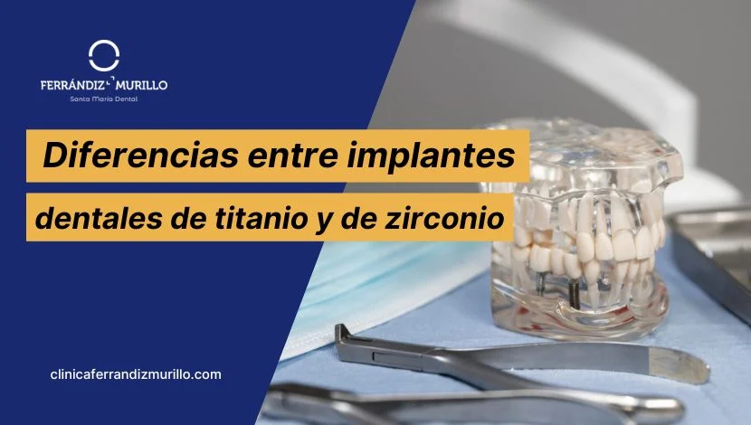 Diferencias entre implantes dentales de titanio y de zirconio