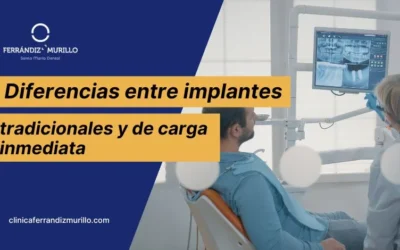 Diferencias entre implantes tradicionales y de carga inmediata: cuál elegir según tu caso