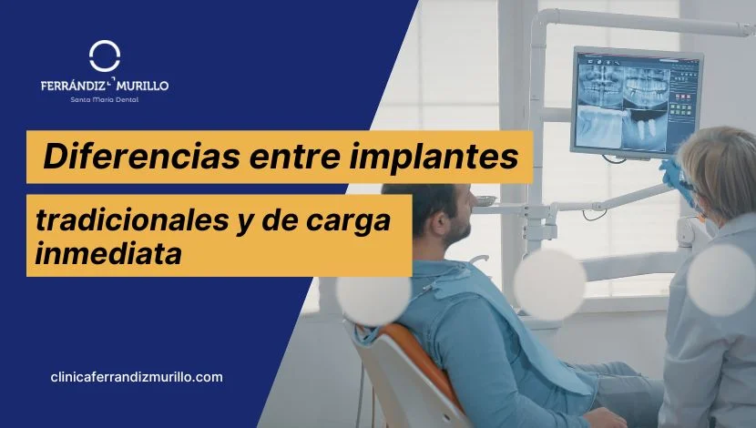 Diferencias entre implantes tradicionales y de carga inmediata: cuál elegir según tu caso