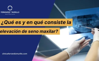 ¿Qué es y en qué consiste la elevación de seno maxilar?
