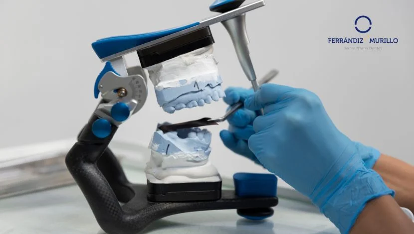 implante dental inmediato