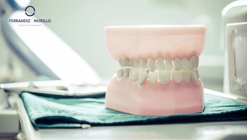 Rehabilitación sobre implantes