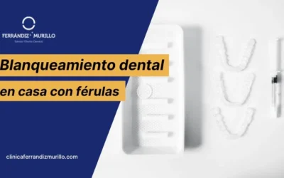 Blanqueamiento dental en casa con férulas