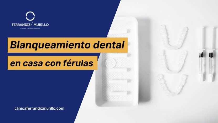 Blanqueamiento dental en casa con férulas