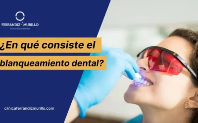 ¿En qué consiste el blanqueamiento dental?