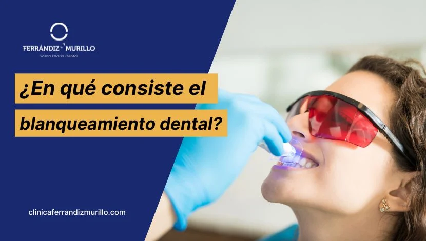 ¿En qué consiste el blanqueamiento dental?