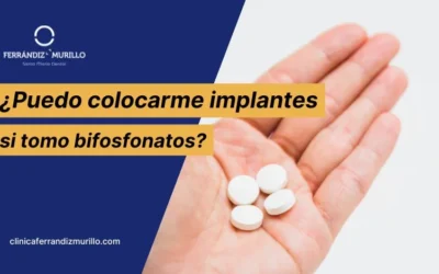 ¿Puedo colocarme implantes dentales si tomo bifosfonatos?