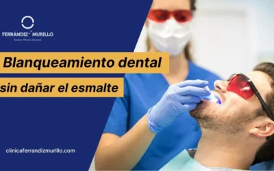 Blanqueamiento dental sin dañar el esmalte (Método no agresivo)