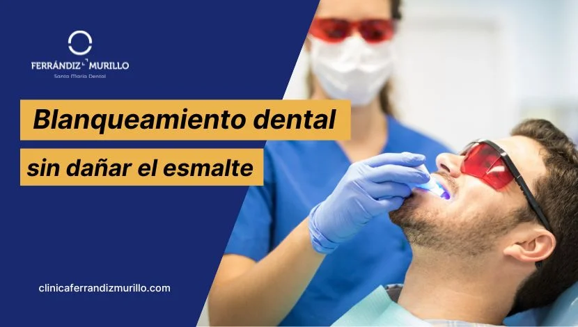 Blanqueamiento dental sin dañar el esmalte (Método no agresivo)