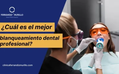 ¿Cuál es el mejor blanqueamiento dental profesional?
