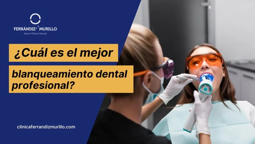 Cual es el mejor blanqueamiento dental profesional