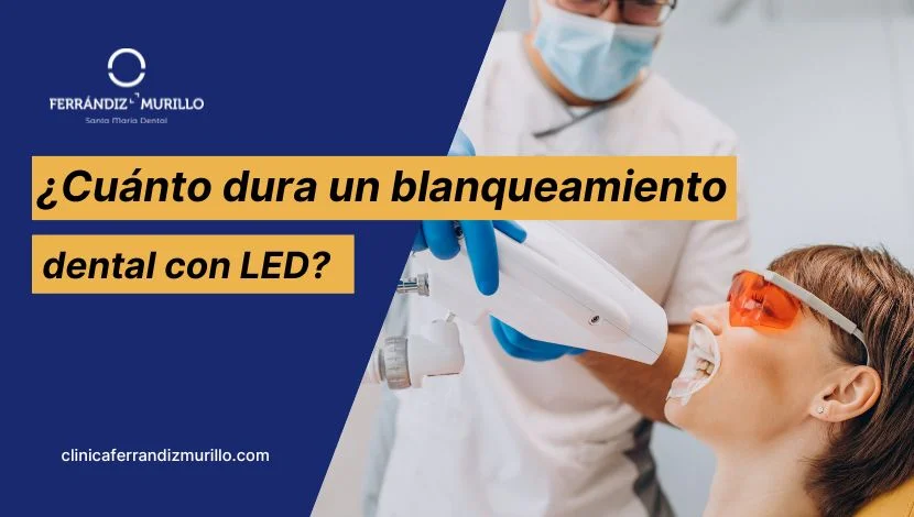 Cuanto dura un blanqueamiento dental con LED