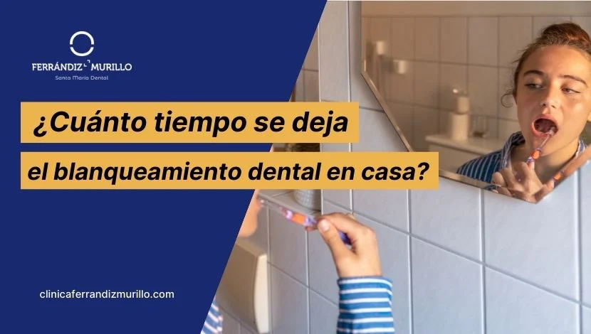 ¿Cuánto tiempo se deja el blanqueamiento dental en casa?