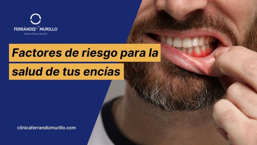 Los 5 factores de riesgo que amenazan la salud de tus encías