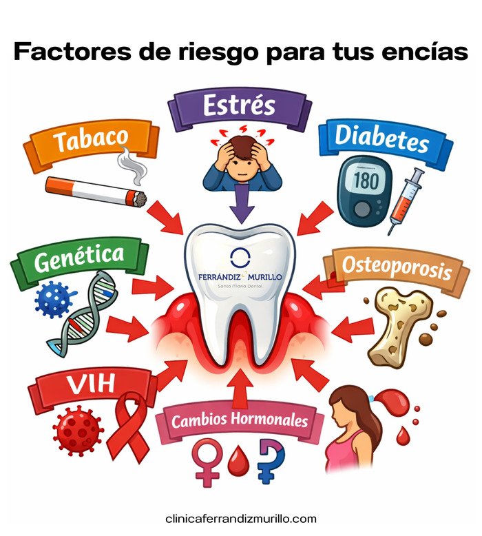 Factores de riesgo para tus encías