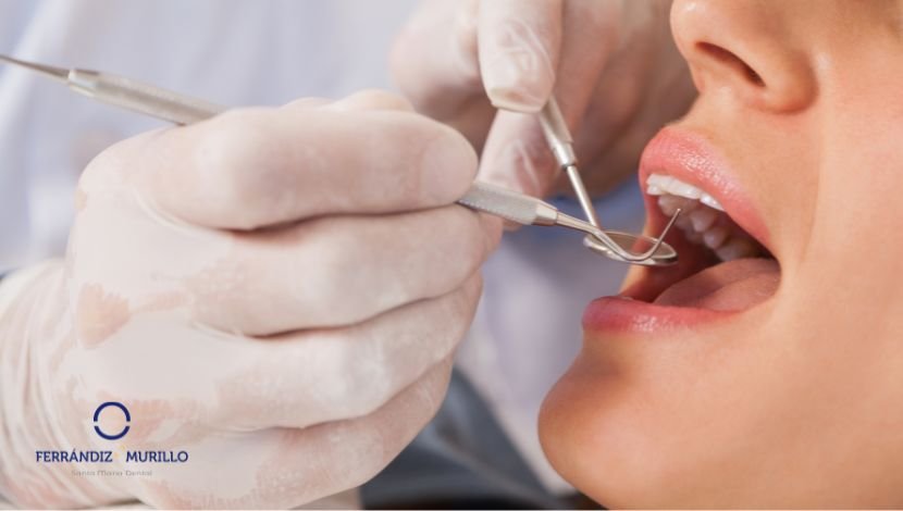 4 beneficios del uso adecuado de antibióticos tras una periodoncia