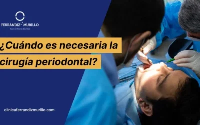 ¿Cuándo es necesaria la cirugía periodontal?