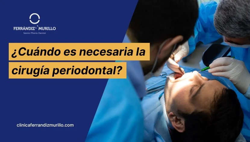 Cuándo es necesaria la cirugía periodontal