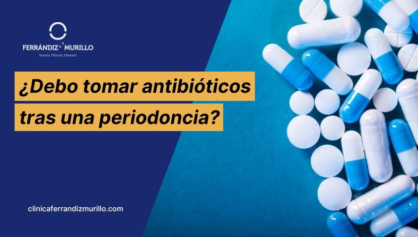 Debo tomar antibióticos tras una periodoncia