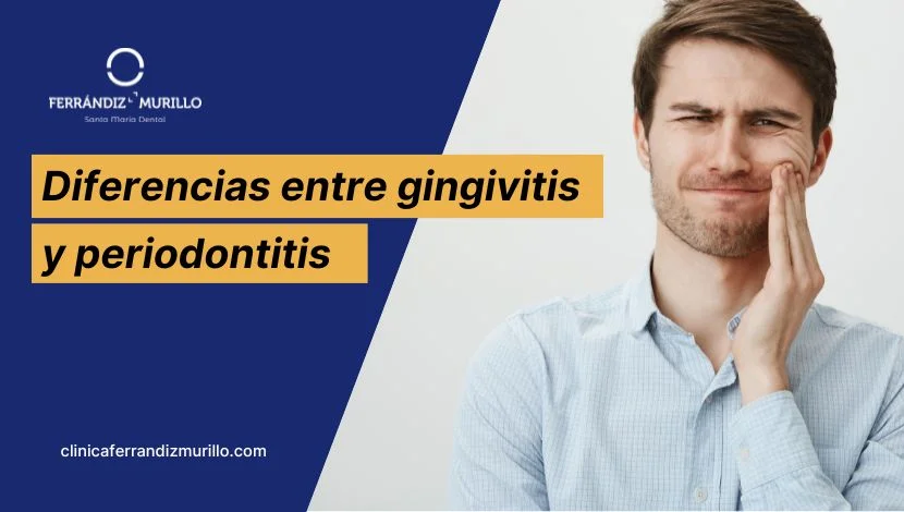 Diferencias entre Gingivitis y Periodontitis