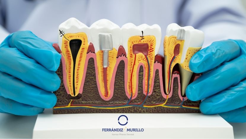 Genética respecto a la salud de las encías