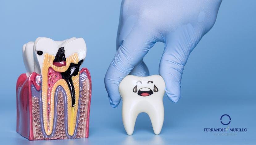 La periodontitis agresiva y su abordaje clínico
