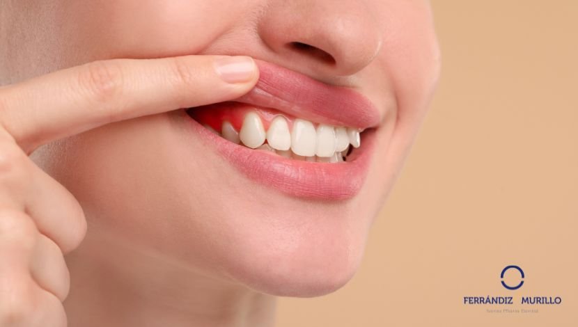 Periodoncia para mi salud de encias