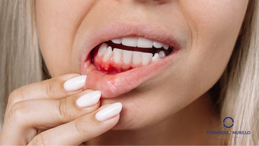 Qué es la salud periodontal