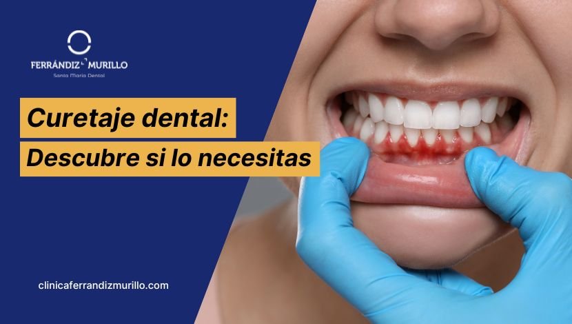 Qué es un curetaje dental