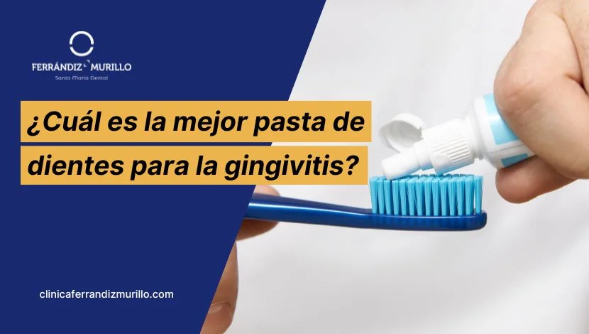 Cuál es la mejor pasta de dientes para la gingivitis