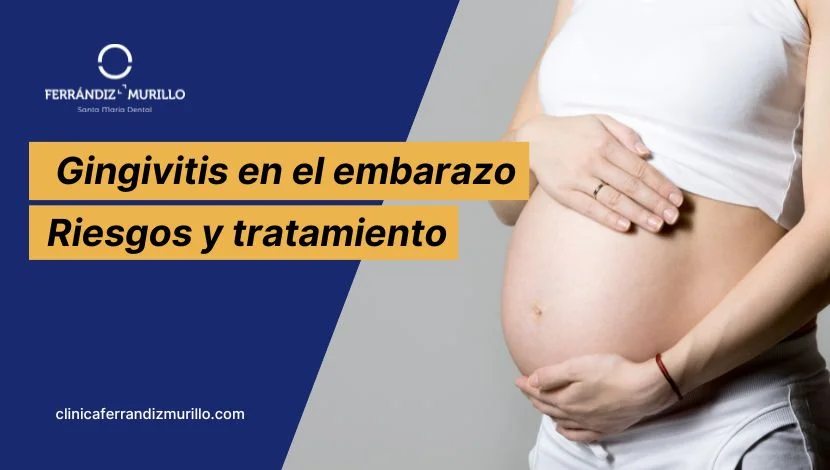 Gingivitis en el embarazo