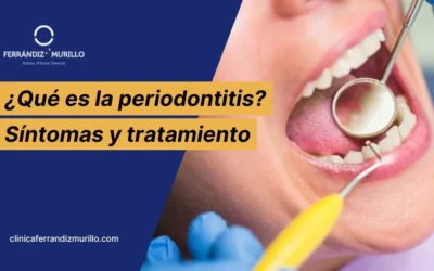 ¿Qué es la periodontitis, cuáles son sus síntomas y tratamiento?