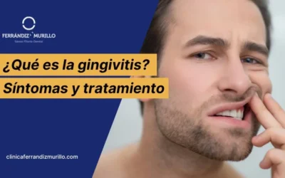 ¿Qué es la gingivitis, cuáles son sus síntomas y tratamiento?